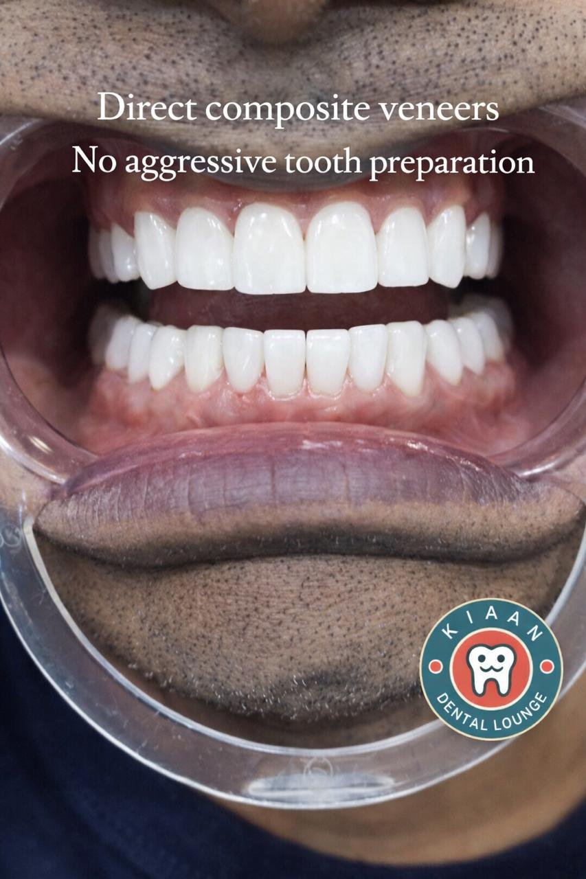 kiaan dental lounge