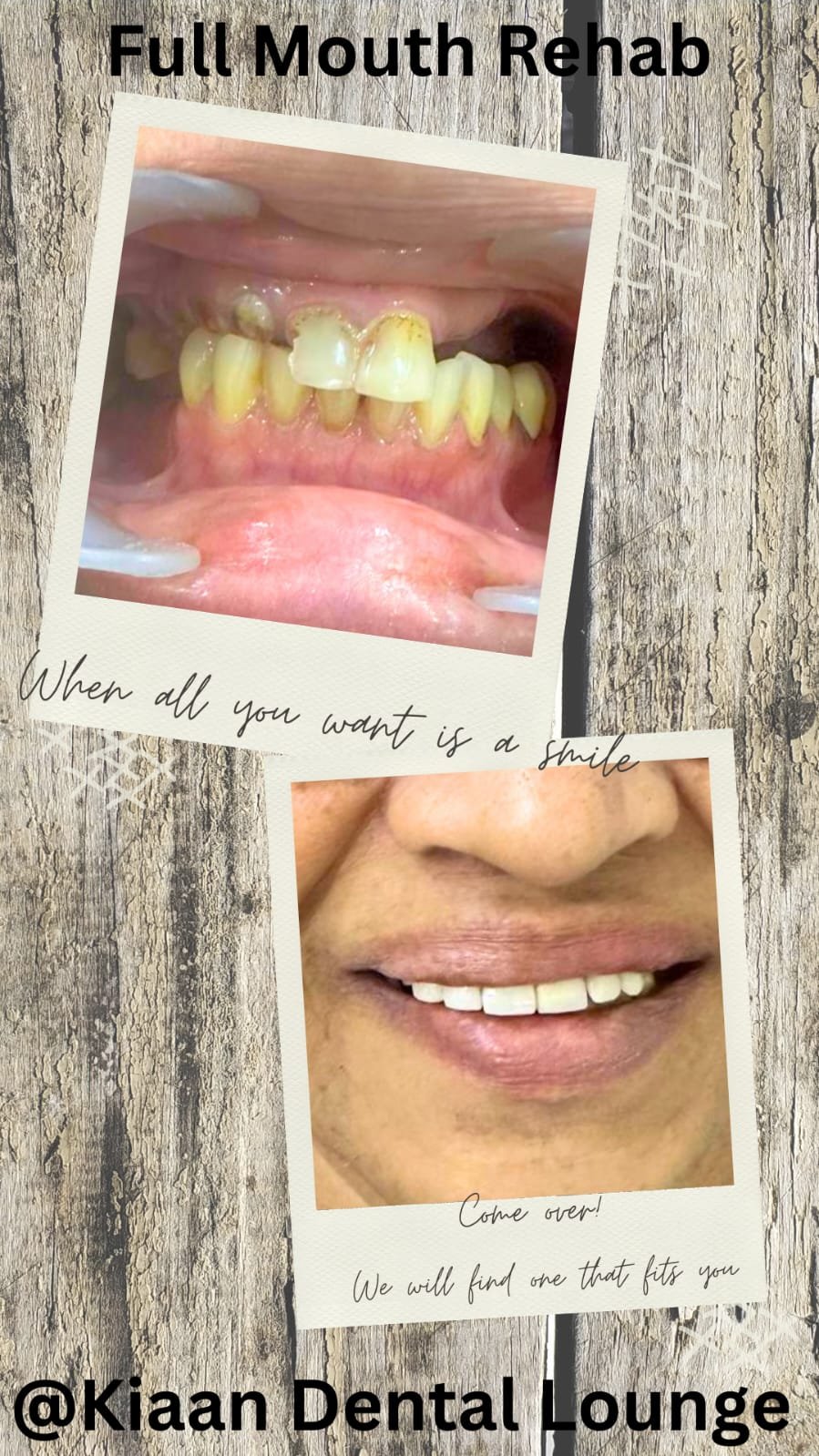 kiaan dental lounge