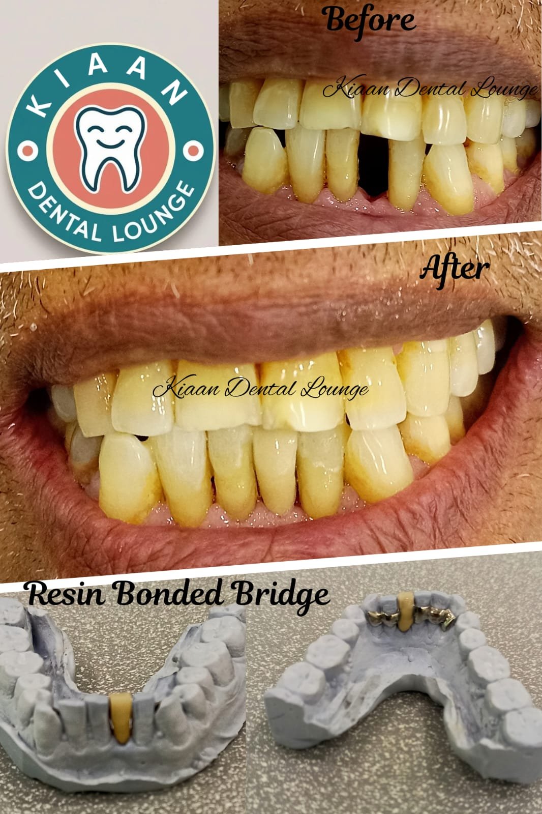 kiaan dental lounge