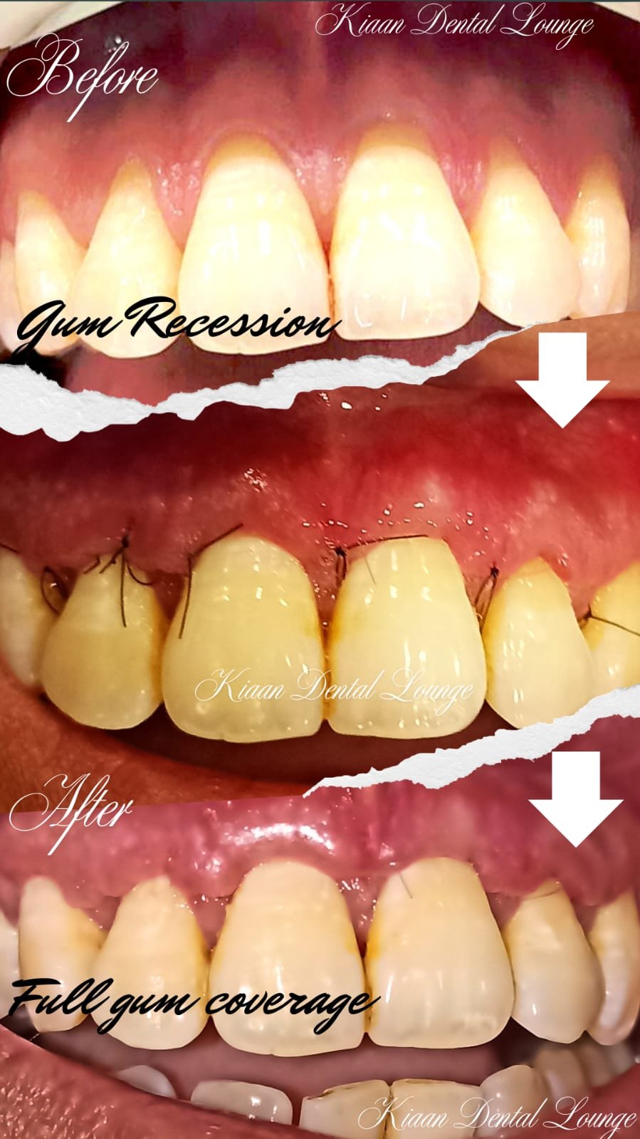 kiaan dental lounge
