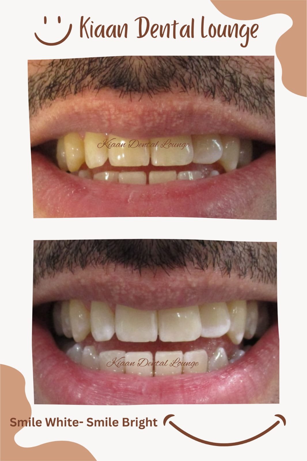kiaan dental lounge