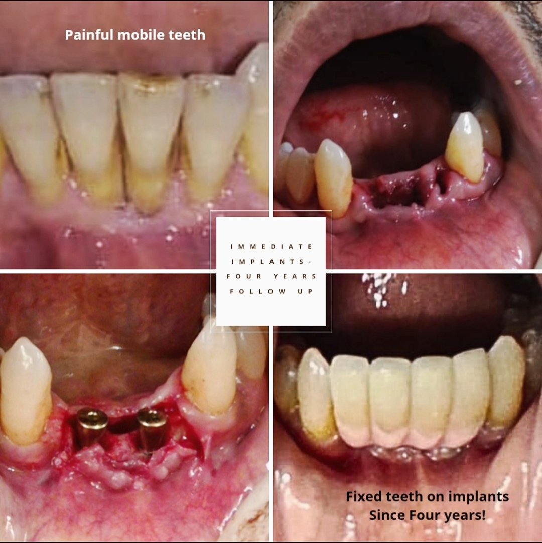 kiaan dental lounge