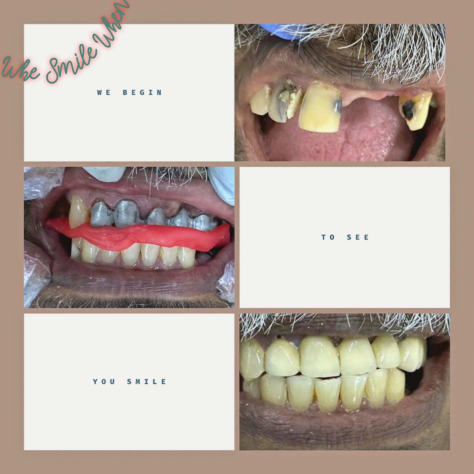 kiaan dental lounge
