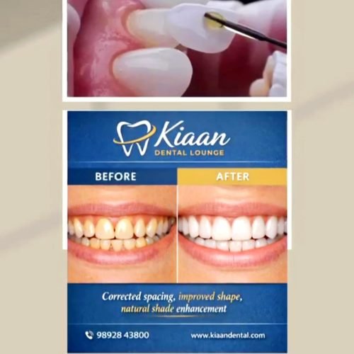 kiaan dental lounge